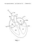 DELIVERY DEVICES AND METHODS FOR HEART VALVE REPAIR diagram and image