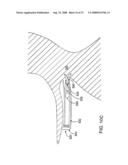 DELIVERY DEVICES AND METHODS FOR HEART VALVE REPAIR diagram and image