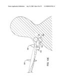 DELIVERY DEVICES AND METHODS FOR HEART VALVE REPAIR diagram and image