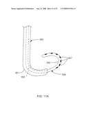 DELIVERY DEVICES AND METHODS FOR HEART VALVE REPAIR diagram and image