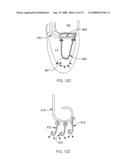 DELIVERY DEVICES AND METHODS FOR HEART VALVE REPAIR diagram and image