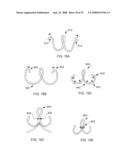 DELIVERY DEVICES AND METHODS FOR HEART VALVE REPAIR diagram and image