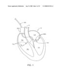 DEVICES AND METHODS FOR HEART VALVE REPAIR diagram and image