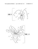 SUTURE ANCHOR AND METHOD diagram and image