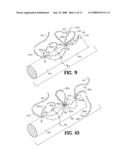 SUTURE ANCHOR AND METHOD diagram and image