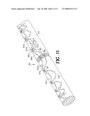 SUTURE ANCHOR AND METHOD diagram and image