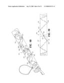 SUTURE ANCHOR AND METHOD diagram and image