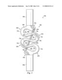 Vertebral Stabilizer diagram and image