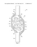 Vertebral Stabilizer diagram and image