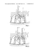 SYSTEM AND METHOD FOR INSERTION OF FLEXIBLE SPINAL STABILIZATION ELEMENT diagram and image