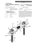 Spinal stabilization device diagram and image