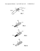 Spinal stabilization device diagram and image