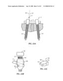 Spinal stabilization device diagram and image