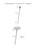 Spinal stabilization device diagram and image