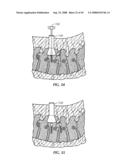 Spinal stabilization device diagram and image