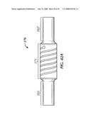 Spinal stabilization device diagram and image