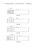 Spinal stabilization device diagram and image