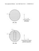 Spinal stabilization device diagram and image