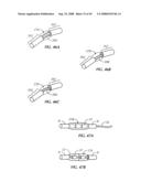 Spinal stabilization device diagram and image