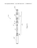 Spinal stabilization device diagram and image