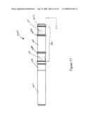 Spinal stabilization device diagram and image