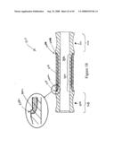 Spinal stabilization device diagram and image