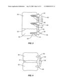 Resorbable Release Mechanism for a Surgical Tether and Methods of Use diagram and image