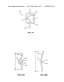 Resorbable Release Mechanism for a Surgical Tether and Methods of Use diagram and image