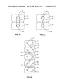 Resorbable Release Mechanism for a Surgical Tether and Methods of Use diagram and image