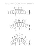 Resorbable Release Mechanism for a Surgical Tether and Methods of Use diagram and image