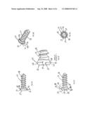 Anterior vertebral plate with quick lock screw diagram and image