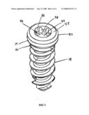 Anterior vertebral plate with closed thread screw diagram and image