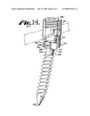 Polyaxial bone screw with shank-retainer insert capture diagram and image