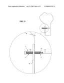 SELF-TAPPING SCREW WITH RESORBABLE TIP diagram and image