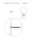 SELF-TAPPING SCREW WITH RESORBABLE TIP diagram and image