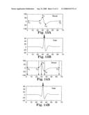 Cardiac rhythm template generation system and method diagram and image