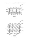 Stent Including a Toggle Lock diagram and image