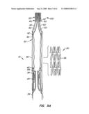 Low Profile Heart Valve and Delivery System diagram and image