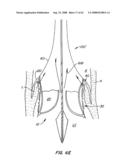 Low Profile Heart Valve and Delivery System diagram and image