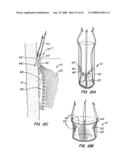 Low Profile Heart Valve and Delivery System diagram and image