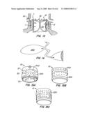 Low Profile Heart Valve and Delivery System diagram and image