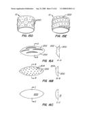 Low Profile Heart Valve and Delivery System diagram and image