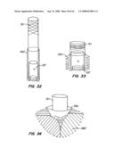 Low Profile Heart Valve and Delivery System diagram and image