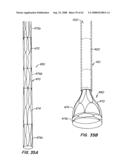 Low Profile Heart Valve and Delivery System diagram and image