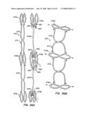 Low Profile Heart Valve and Delivery System diagram and image