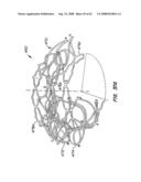 Low Profile Heart Valve and Delivery System diagram and image