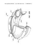 Low Profile Heart Valve and Delivery System diagram and image