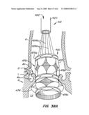 Low Profile Heart Valve and Delivery System diagram and image