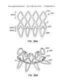 Low Profile Heart Valve and Delivery System diagram and image