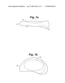 METHOD AND SYSTEM FOR MAMMALIAN JOINT RESURFACING diagram and image